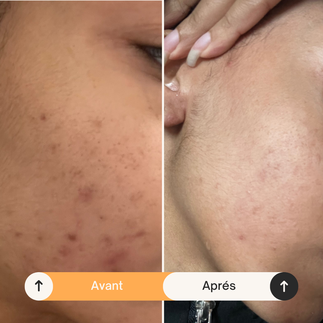 Savon Perfect Skin au Citron & Curcuma