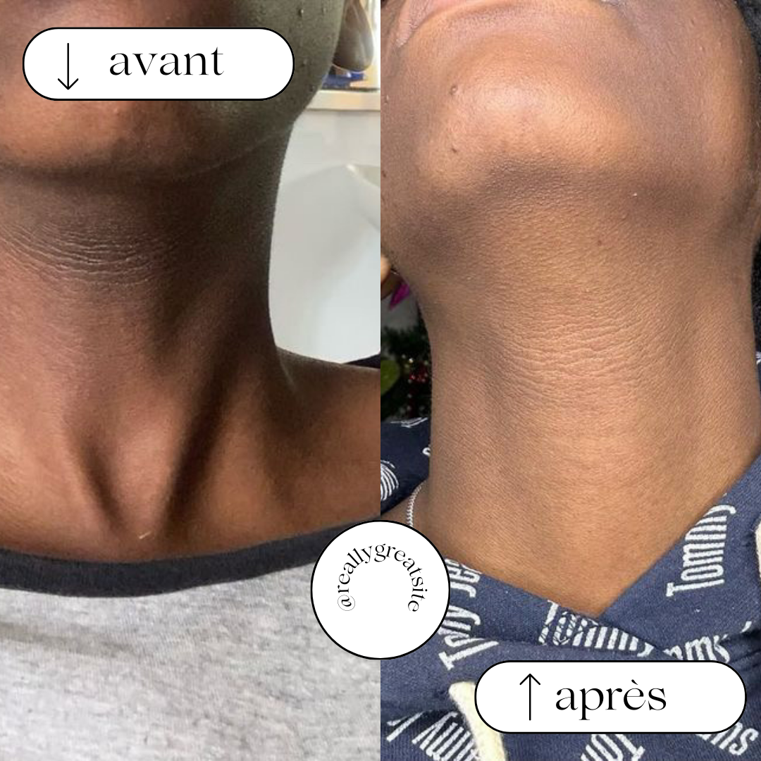 DUO Baume + Gommage Anti-Imperfection